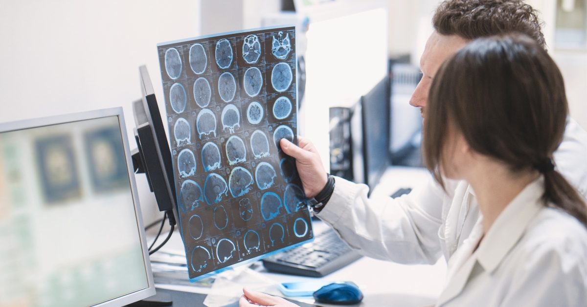 Alzheimer : un test rapide pour détecter la maladie avant les symptômes