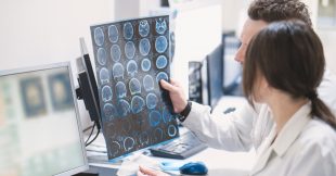 Alzheimer : un test rapide pour détecter la maladie avant les symptômes Alzheimer : un test rapide pour détecter la maladie avant les symptômes