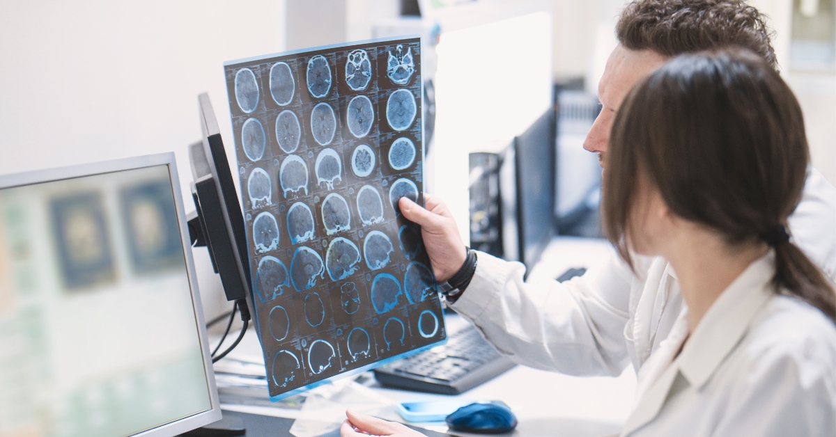 Alzheimer : un test rapide pour détecter la maladie avant les symptômes Alzheimer : un test rapide pour détecter la maladie avant les symptômes