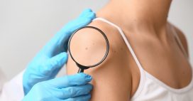 Cancer de la peau : un vaccin personnalisé franchit une étape historique Cancer de la peau : un vaccin personnalisé franchit une étape historique