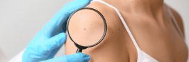 Cancer de la peau : un vaccin personnalisé franchit une étape historique Cancer de la peau : un vaccin personnalisé franchit une étape historique